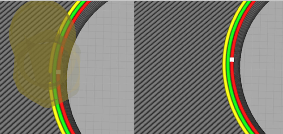 Concentric top surface pattern - Is this a bug? - Bambu Lab X1C - Bambu ...